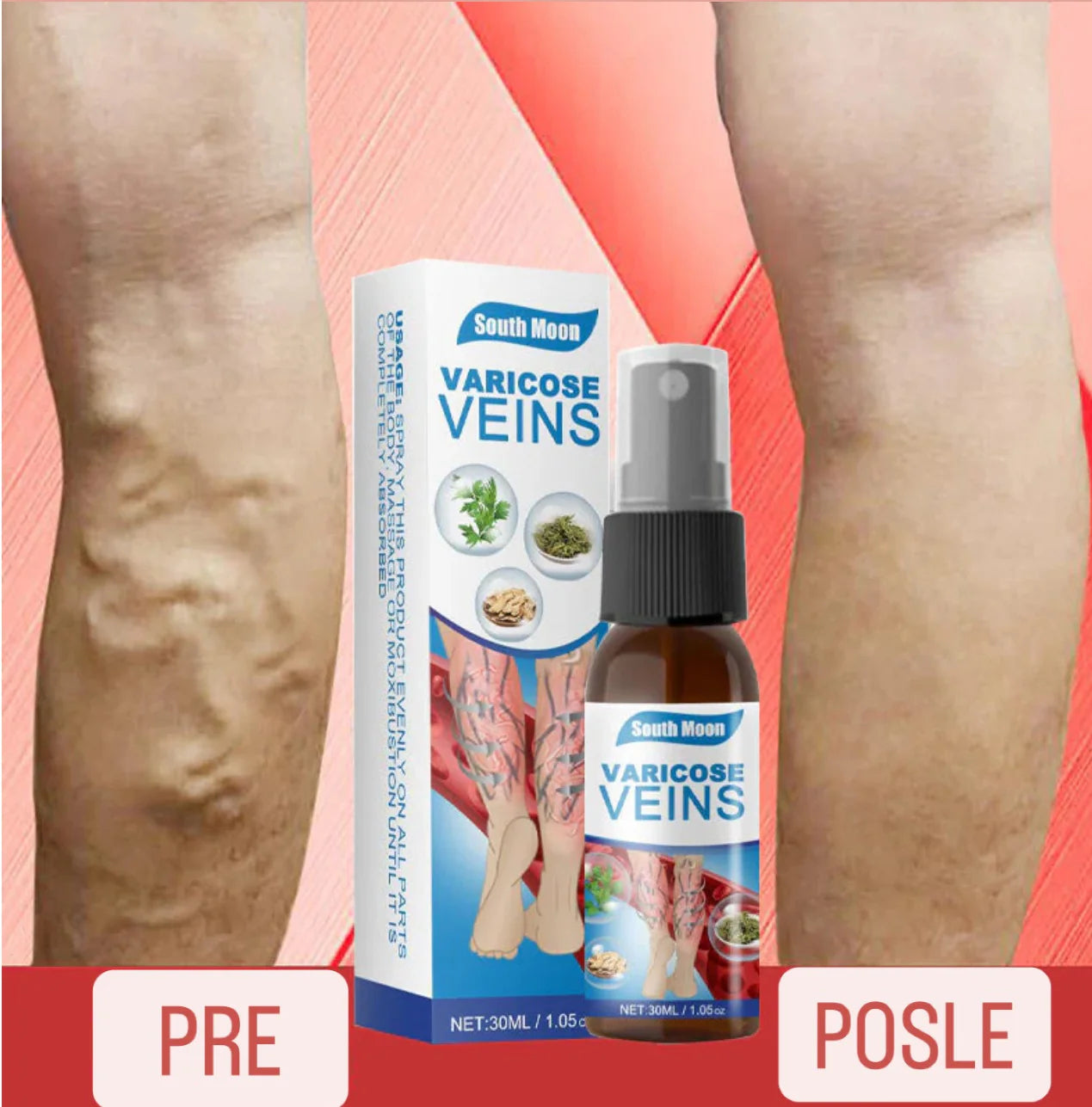 Prirodni sprej za proširene vene